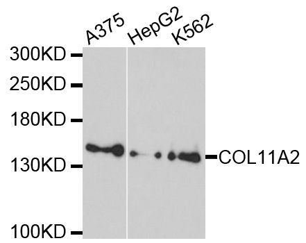 Western blot - COL11A2 Polyclonal Antibody (144-10473)