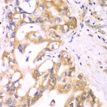 Immunohistochemistry - ACADS Polyclonal Antibody (144-60044)
