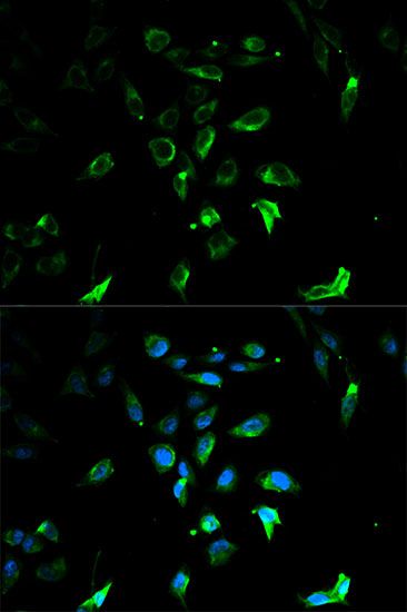 Immunofluorescence - STAR Polyclonal Antibody (144-60053)