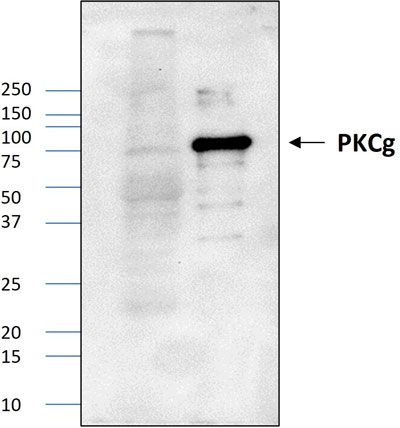 Western blot