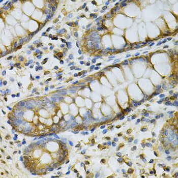 Immunohistochemistry - GSTM2 Antibody (144-60360)