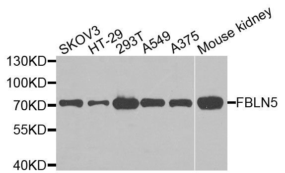 Western blot - FBLN5 antibody (144-09961)