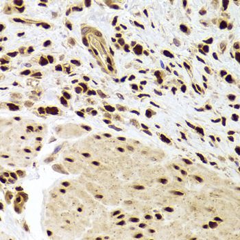 Immunohistochemistry - ANP32A Antibody (144-05768)