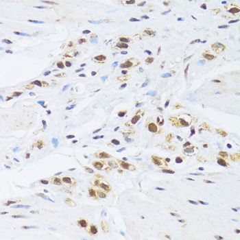 Immunohistochemistry - GABPB1 Polyclonal Antibody (144-06909)
