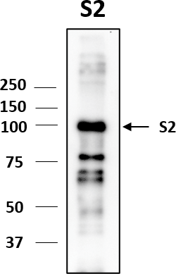 Western blot image