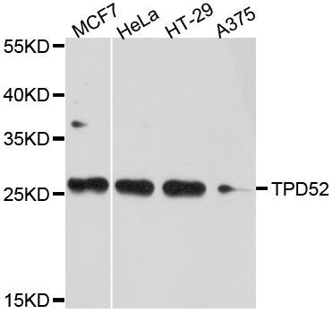 Western blot - TPD52 Polyclonal Antibody (144-010254)