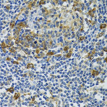 Immunohistochemistry - HSPH1 antibody (144-06622)