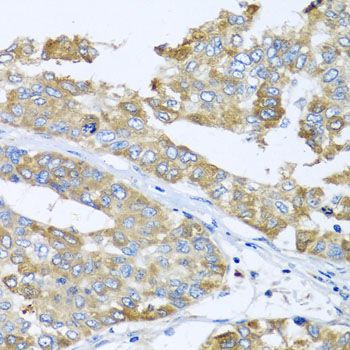 Immunohistochemistry - COQ7 antibody (144-07768)