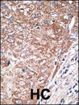 IHC-P