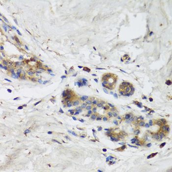 Immunohistochemistry - ISG15 Antibody (144-01182)