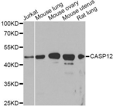 Western blot - CASP12 Polyclonal Antibody (144-00217)