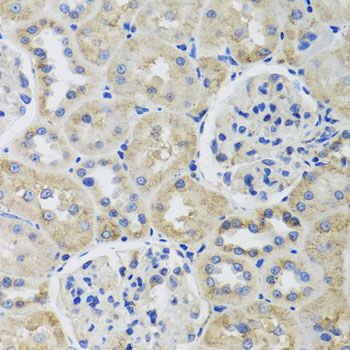 Immunohistochemistry - TUBB8 antibody (144-12617)