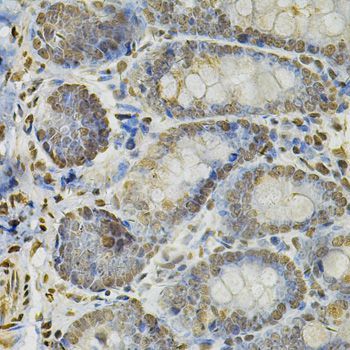 Immunohistochemistry - IFI16 Antibody (144-60546)