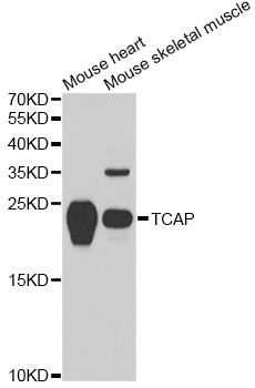 Western blot - TCAP antibody (144-60395)