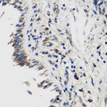 Immunohistochemistry - SMYD1 Polyclonal Antibody (144-02340)