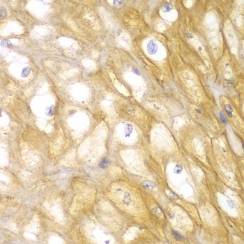 Immunohistochemistry - ACTN1 antibody (144-01160)