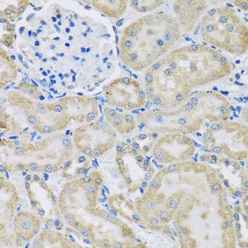 Immunohistochemistry - DCP2 antibody (144-08282)