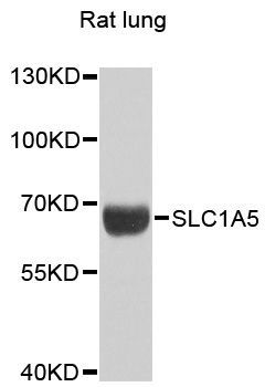 Western blot - SLC1A5 antibody (144-60088)