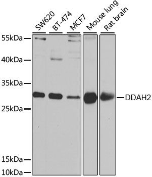 Western blot - DDAH2 Polyclonal Antibody (144-06457)