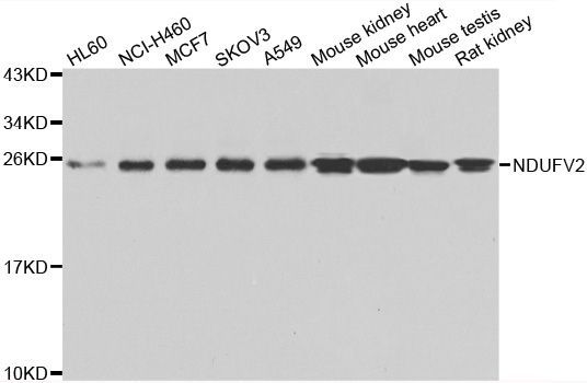 Western blot - NDUFV2 Polyclonal Antibody (144-07442)