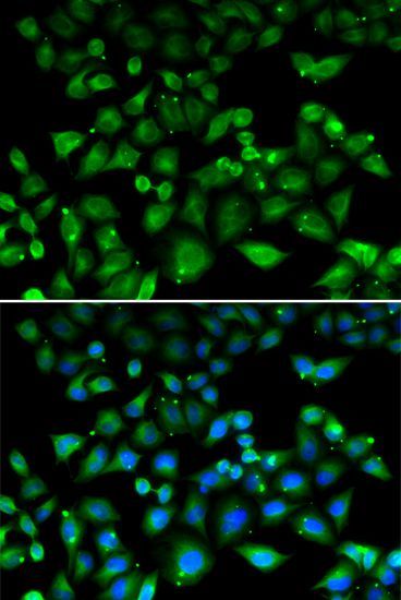 Immunofluorescence - NHLRC1 antibody (144-06669)