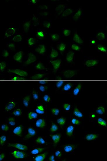 Immunofluorescence - PRF1 Polyclonal Antibody (144-00093)