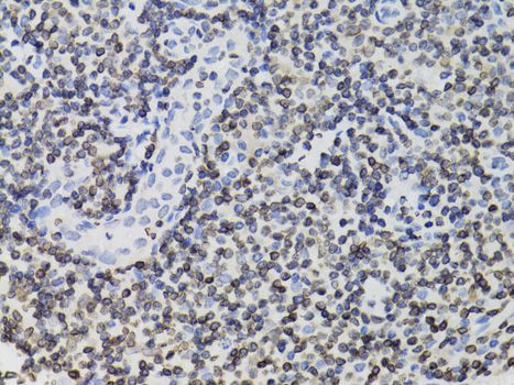 Immunohistochemistry - [KO Validated] TMPO Polyclonal Antibody (144-02534)