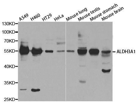 Western blot - ALDH3A1 antibody (144-05502)