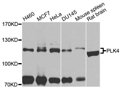 Western blot - PLK4 antibody (144-09863)