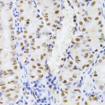 Immunohistochemistry - XRCC5 Antibody (144-05862)