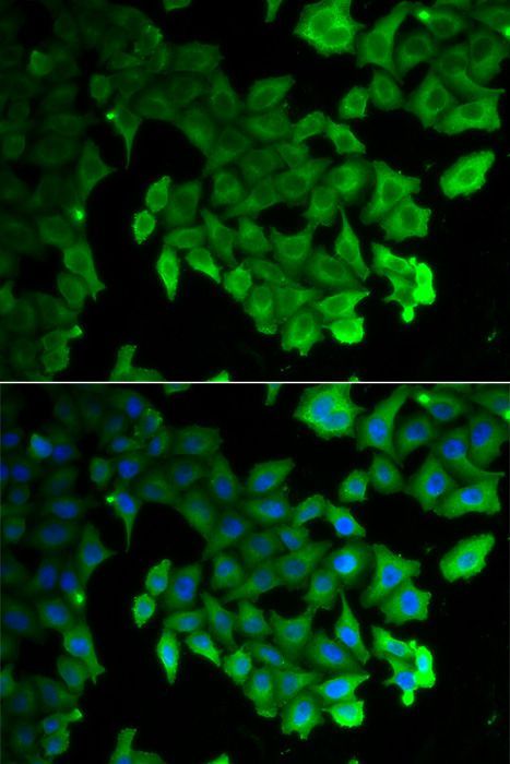 Immunofluorescence - MAP1LC3A Polyclonal Antibody (144-05618)