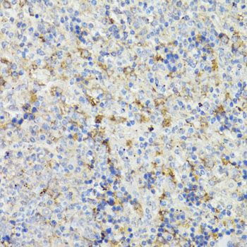 Immunohistochemistry - CHGA antibody (144-61314)