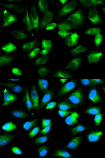 Immunofluorescence - ARHGDIA Polyclonal Antibody (144-603448)