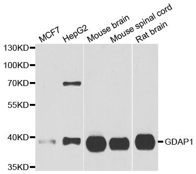 Western blot - GDAP1 antibody (144-06601)