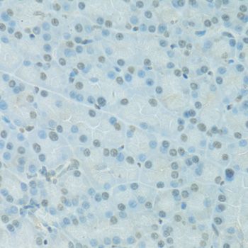 Immunohistochemistry - PDC Polyclonal Antibody (144-60738)