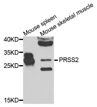 Western blot - PRSS2 antibody (144-07923)