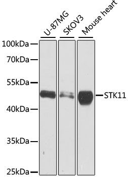 Western blot - STK11 antibody (144-02122)