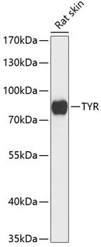 Western blot