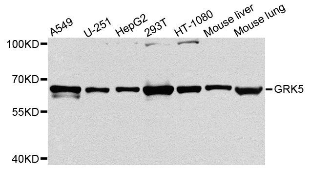 Western blot - GRK5 Polyclonal Antibody (144-03899)