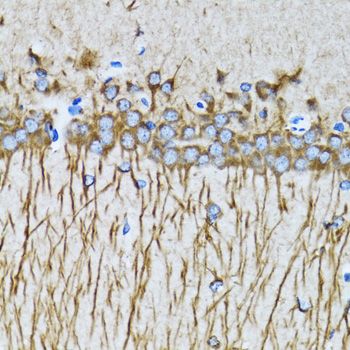 Immunohistochemistry - MAP1LC3A antibody (144-011438)