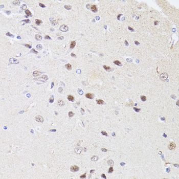Immunohistochemistry - DMAP1 antibody (144-02324)