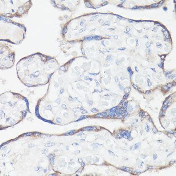 Immunohistochemistry - CLUH Polyclonal Antibody (144-010140)