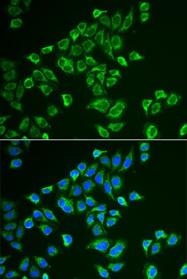 Immunofluorescence - TAC3 antibody (144-06312)