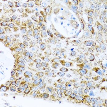 Immunohistochemistry - LRPPRC antibody (144-03365)