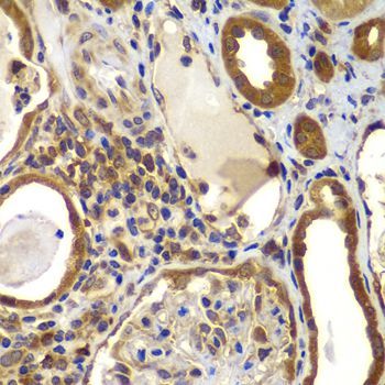 Immunohistochemistry - NME2 antibody (144-07443)