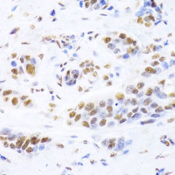 Immunohistochemistry - XRCC5 Antibody (144-05862)
