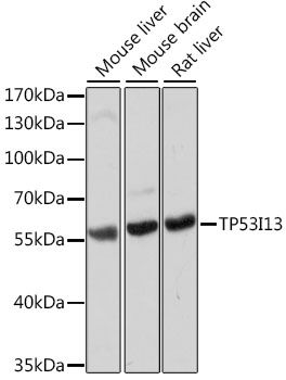 Western blot - TP53I13 antibody (144-015924)