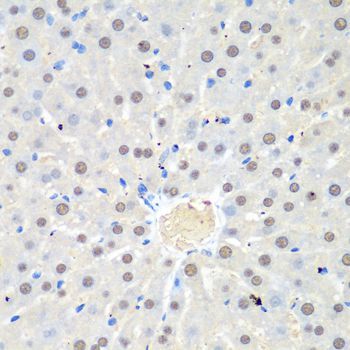 Immunohistochemistry - WDR48 Polyclonal Antibody (144-06854)