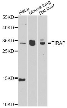 Western blot - TIRAP antibody (144-12606)