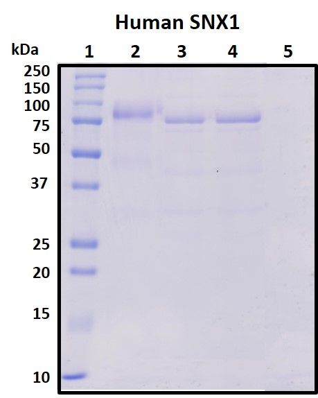 SDS-PAGE